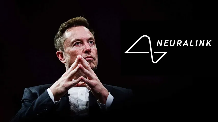 Neuralink : ఎలాన్ మస్క్ సంచలనం.. రెండో వ్యక్తికి ఆర్టిఫిషియల్ బ్రెయిన్..  