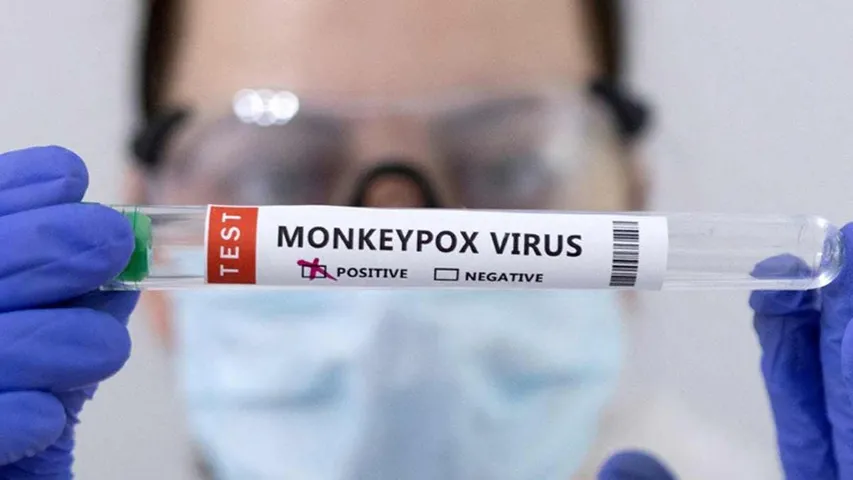 Monkeypox: ఇండియాలో మంకీపాక్స్ కలకలం.. ఆస్పత్రిలో అనుమానితుడు