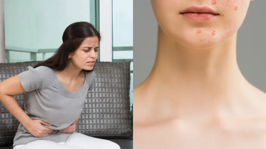Beauty Tips: పీరియడ్స్ టైంలో తప్పక పాటించాల్సిన జాగ్రత్తలివే!