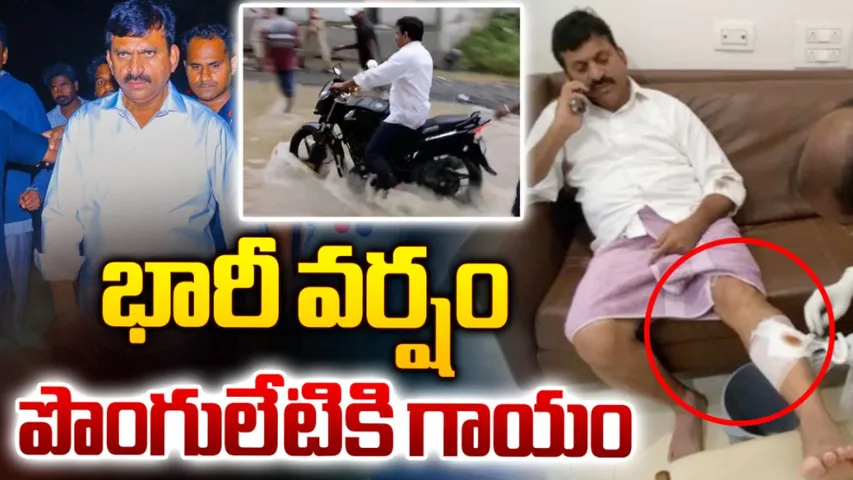 Minister Ponguleti : మంత్రి పొంగులేటికి గాయం!