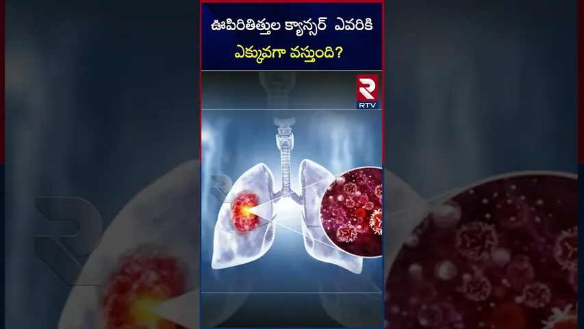 బీ అలర్ట్‌..! ఊపిరితిత్తుల క్యాన్సర్‌  వీరిలోనే ఎక్కువ | Be alert Lung cancer prevention |RTV