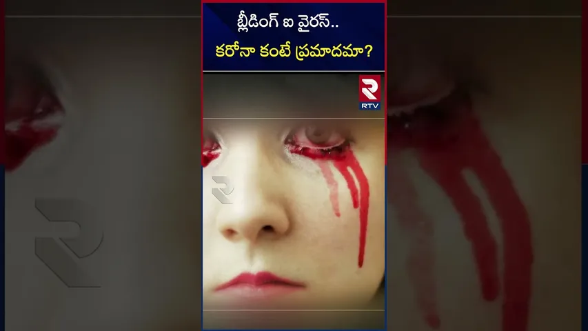 దడపుట్టిస్తున్న బ్లీడింగ్ ఐ వైరస్.. ఇది ఎంత డేంజర్ అంటే..? |Bleeding eye virus |Africa |RTV