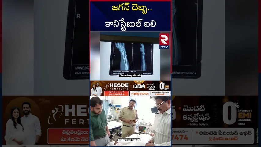 జగన్‌ పర్యటనలో హెడ్‌ కానిస్టేబుల్‌కు గాయాలు | Head Constable Malakondaiah Incident | Ys Jagan | RTV