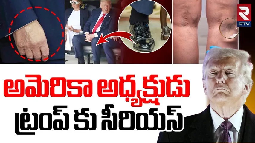 Donald Trump Health Update : డోనాల్డ్ ట్రంప్ ఆరోగ్య పరిస్థితి | White House Makes Shock Announcement
