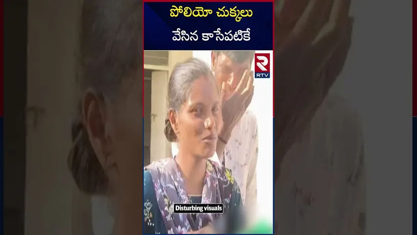 పోలియో చుక్కలు వేసిన కాసేపటికే | Sangareddy Polio Drops Incident | Pulse Polio Drive 2025 | RTV