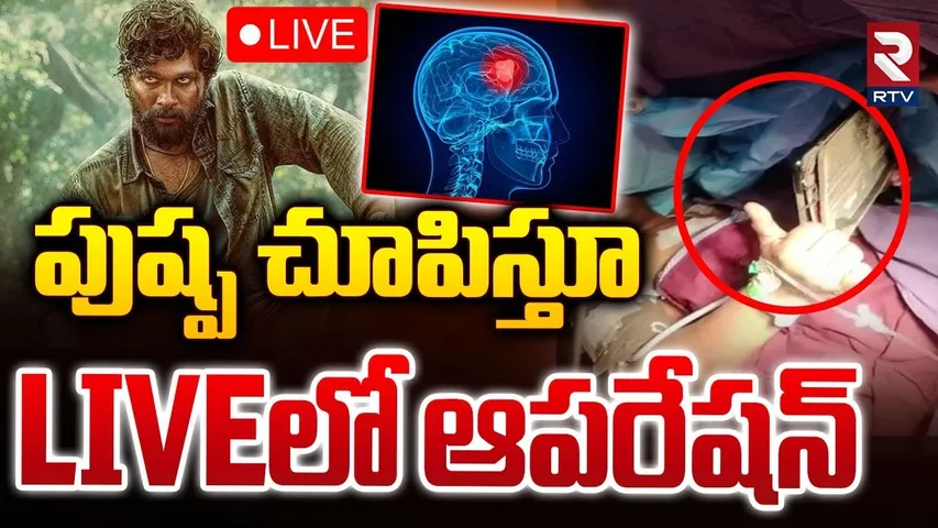 🛑LIVE : పుష్ప చూపిస్తూ LIVEలో ఆపరేషన్ | Brain Tumor Patient Watching Pushpa Movie | RTV