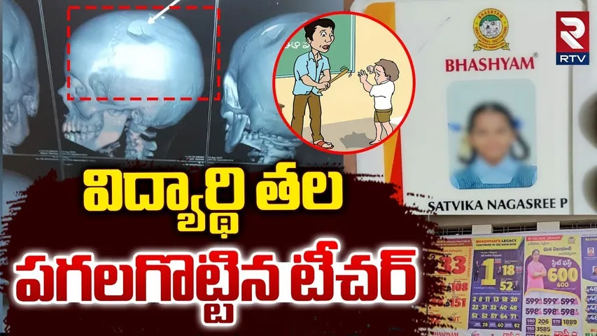 విద్యార్థి తల పగలగొట్టిన టీచర్ | Bhashyam School Incident | Teacher | Punganur | RTV