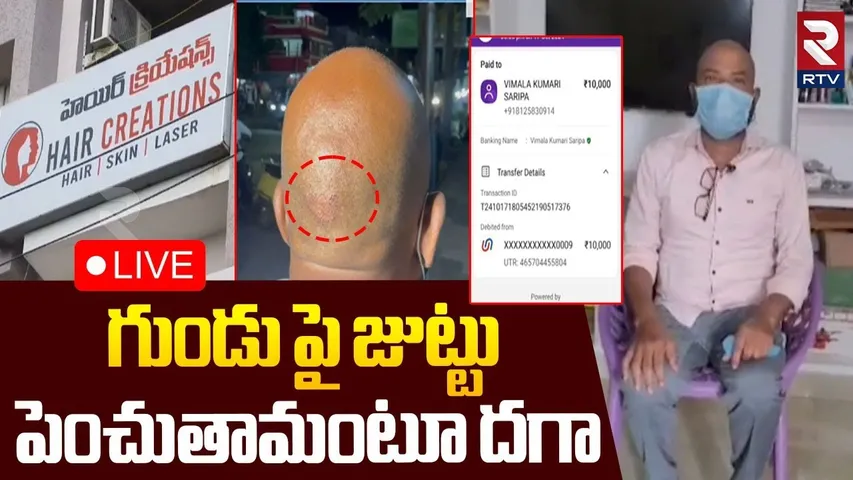 Kakinada Hair Transplant Scam🔴LIVE : గుండు పై జుట్టు పెంచుతామంటూ దగా | VRS Hair Clinic Scam | RTV