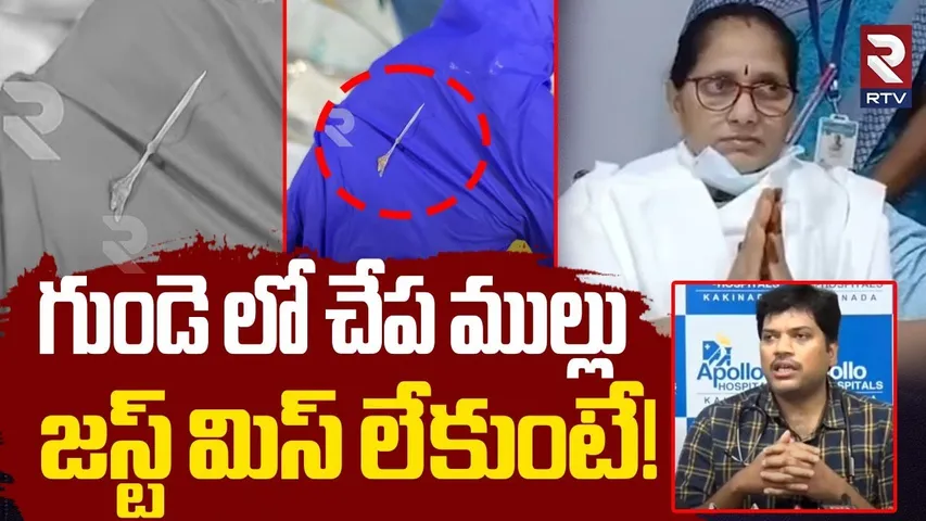 Doctors Save Woman Life | గుండె లో చేప ముల్లు | Fish Thorn Stuck In Heart | Kakinada Incident | RTV
