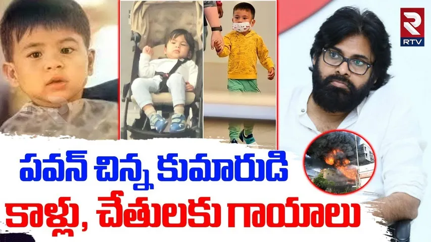 పవన్ కుమారుడి  కాళ్లు, చేతులకు గాయాలు | Pawan Kalyan Son Mark Shankar School Fire Incident | RTV