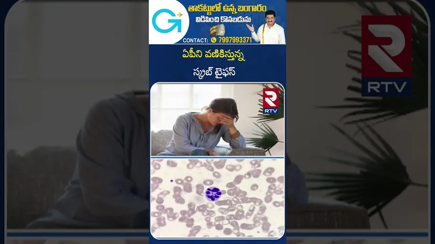 Scrub Typhus Fast Spreads In AP | ఏపీని వణికిస్తున్న స్క్రబ్ టైఫస్ | Scrub Typhus Cases | RTV