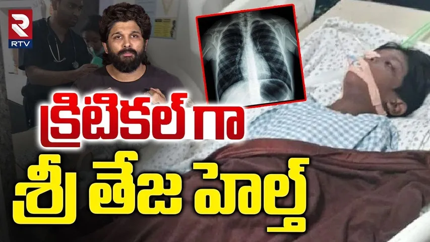 క్రిటికల్ గా శ్రీ తేజ హెల్త్ | Sri Teja Health Updates | Allu Arjun | Sandhya Theatre Incident