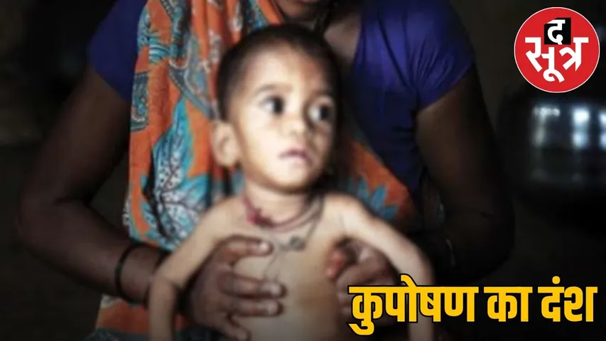 Picture of malnutrition in Madhya Pradesh