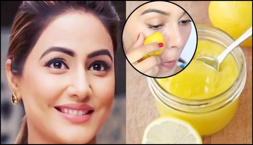 Best Natural Home Remedies For All Your Skin Problems