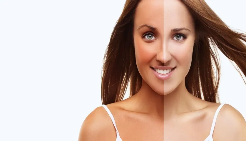 “Ghar Ke Nuskhe”! Try Them To Get Rid Of Patchy Tan Lines During Lockdown