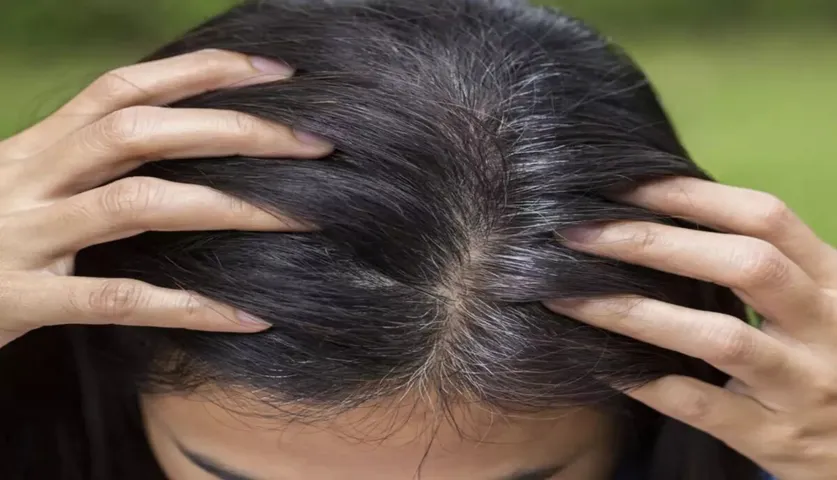No More Premature Greying: This DIY Hair Mask Is All You Need To Deal With Grey Hair