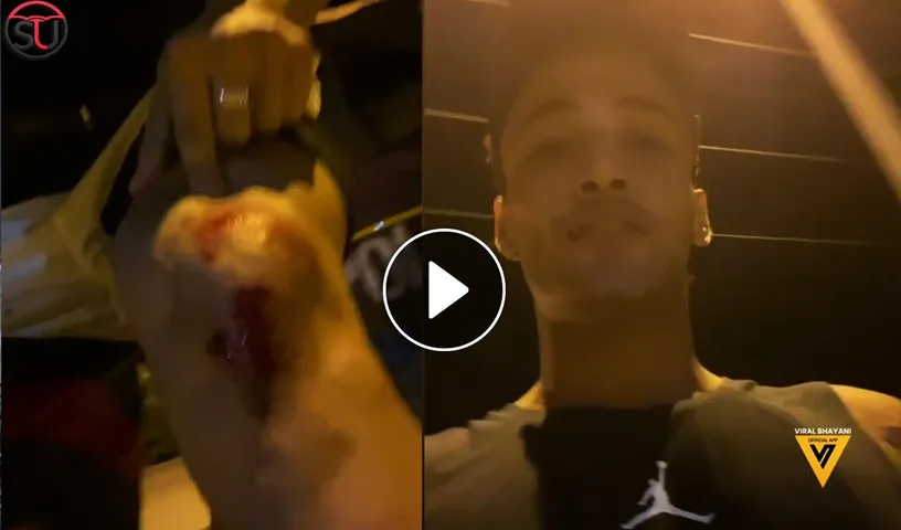 Asim Riaz Attacked On The Street While He Was Cycling, Shares Video Of Bruises And Injuries