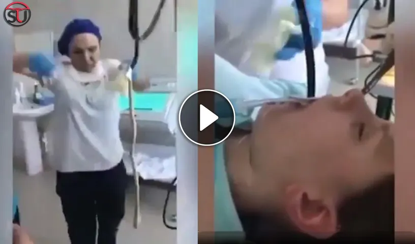 Watch Viral Scary Video: Doctor Pulls Out 4 Feet Long Snake From Woman's Mouth