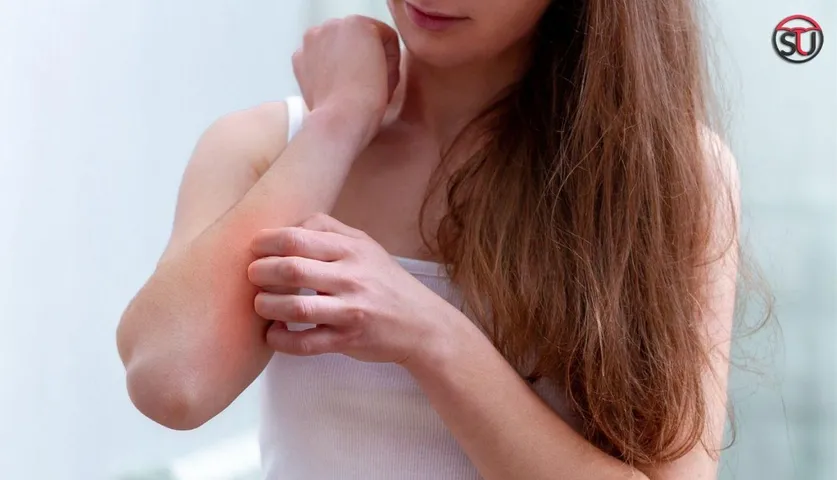 Got Rashes On Skin? It Could Be Leukemia, Learn About Its Symptoms And Causes Here