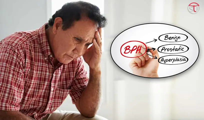 Symptoms, Causes And Treatment Of Benign Prostatic Hyperplasia (BPH)