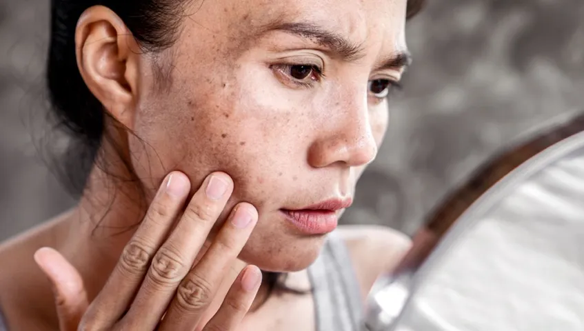 Why Skin Cancer is The Most Common Form of Cancer?