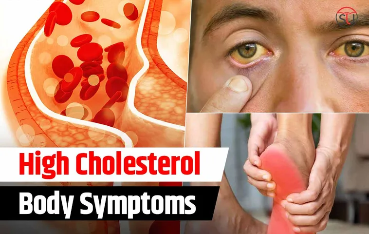 High Cholesterol: Mild Issues That Might Be The Symptoms Of It, Check Out
