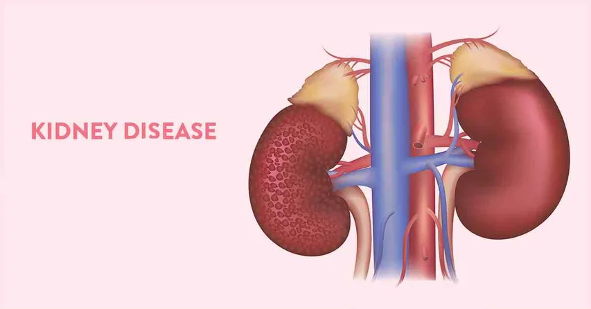 Is Using Plastic Hazardous For Kidneys? What are Its Harmful Results ? Know Here