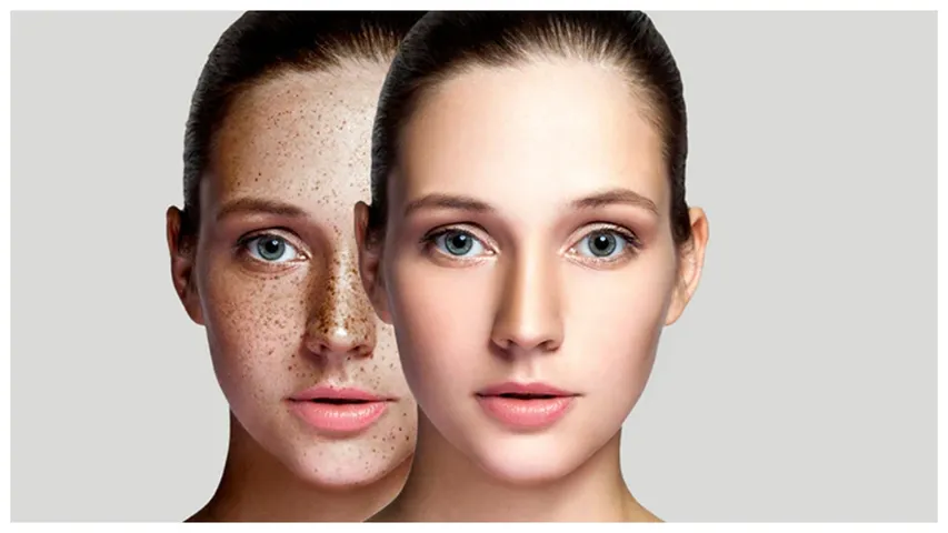Dark Spots