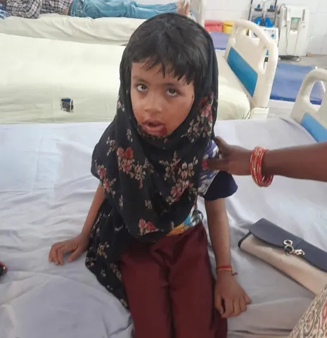 मुरादाबाद:जनपद से आवारा कुत्तों के हमले के मामले थमने का नाम नहीं ले रहे है। बीते दिनों कुंदरकी थाना क्षेत्र में एक मासूम को कुत्तों ने नोंच नोंच कर मौत के घाट उतार दिया था। 