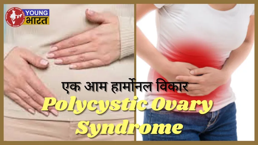Polycystic Ovary Syndrome