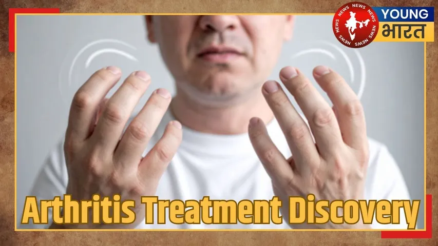 Arthritis Treatment Discovery