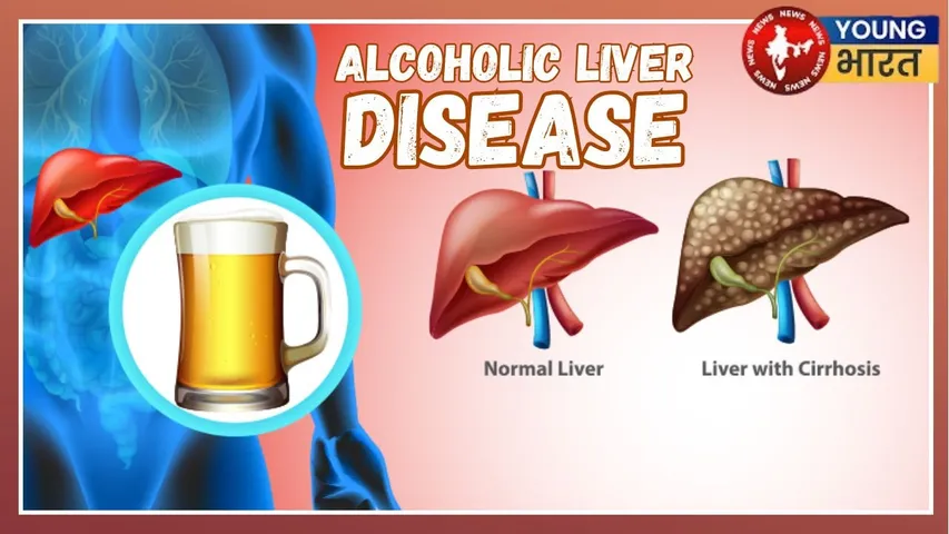 _Alcoholic Disease