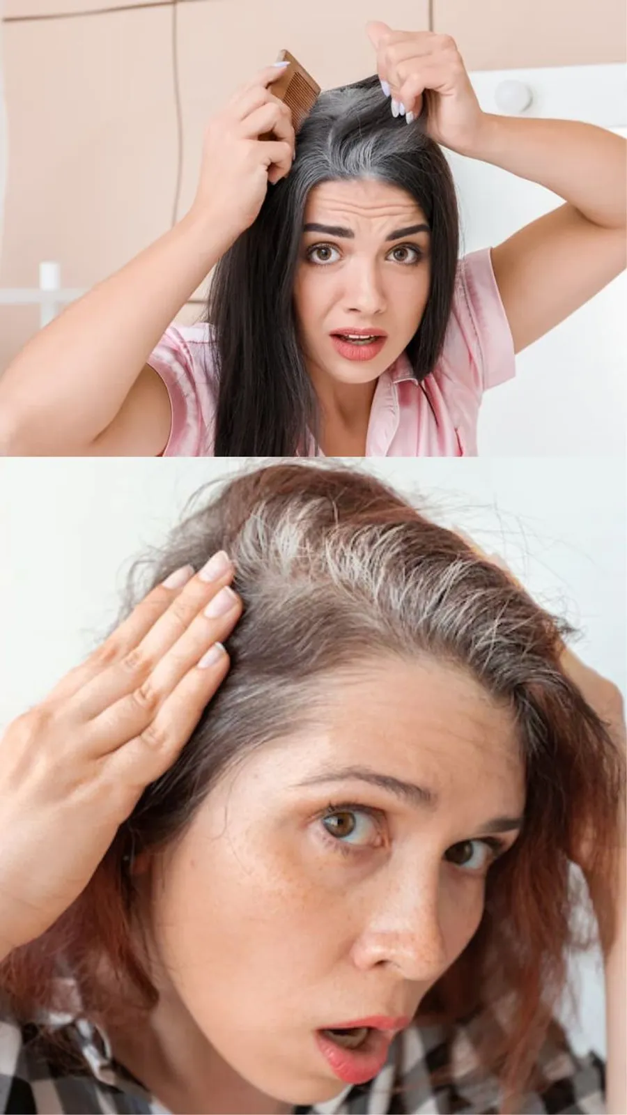 White hair problem 1