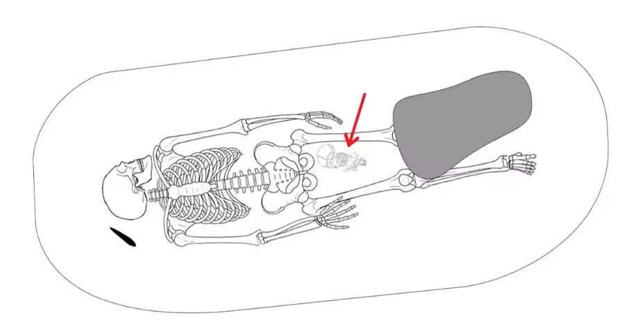 Interpretative drawing of a grave from Fjälkinge, Sweden, of an adult woman buried together with newborn placed between her thighs. Note that the legs of the woman’s body have been weighed down by a boulder. Matt Hitchcock / Body-Politics, CC BY-SA