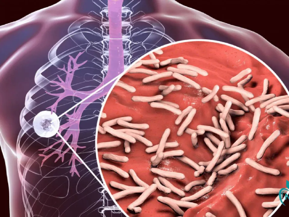 ইওউঝগফদক্স