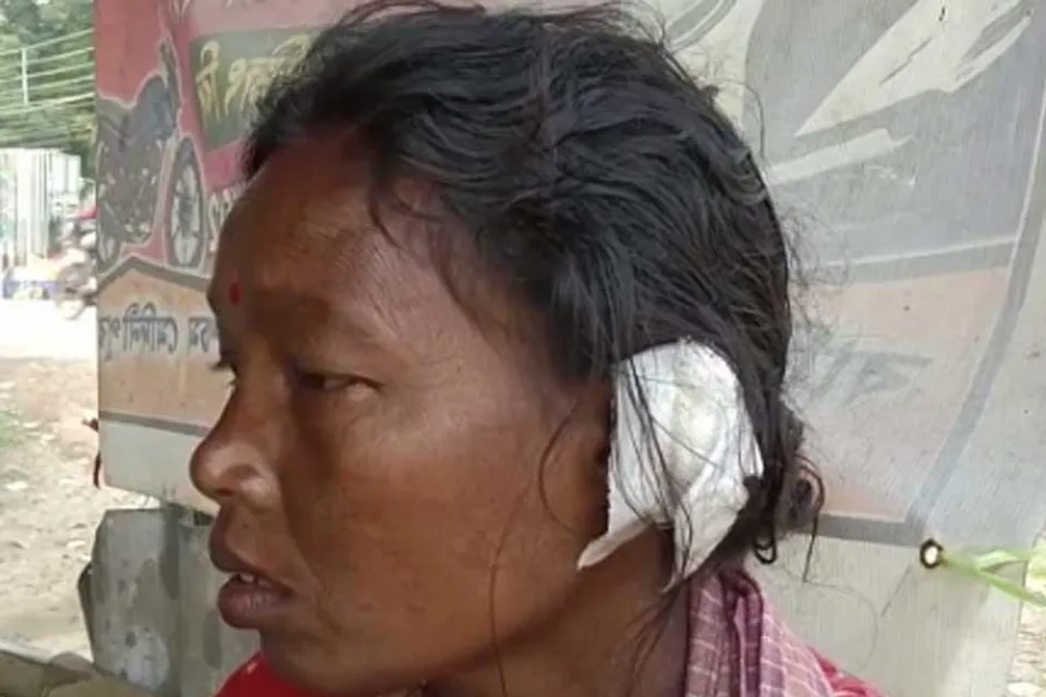 পারিবারিক বিবাদের জেরে মহিলার কান ছিঁড়লো আরেক মহিলা