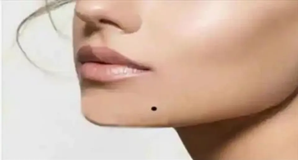 থুতনির বাঁ দিকে তিল?