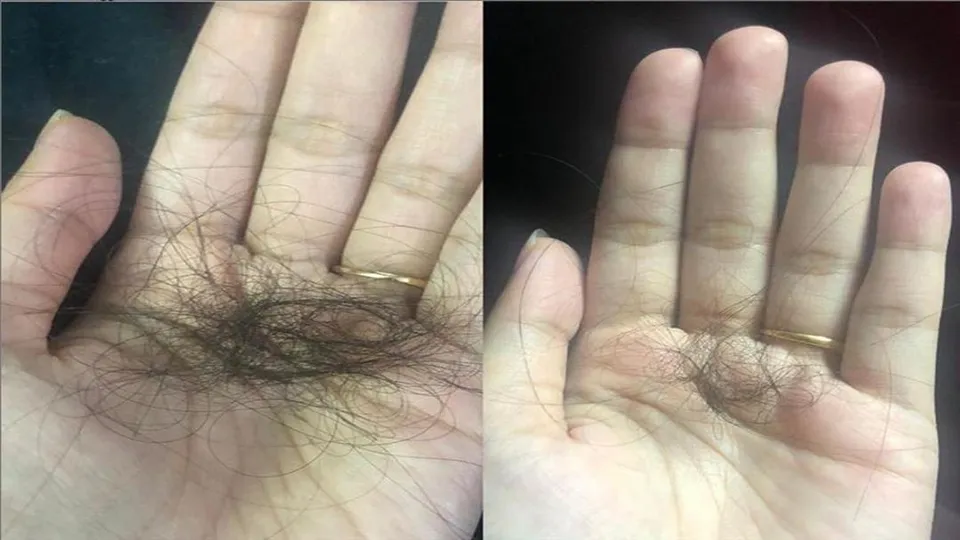 অতিরিক্ত চিন্তা থেকে হতে পারে এই রোগ