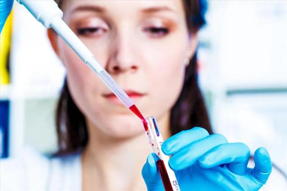 এই ঘরোয়া টোটকায় সাড়বে লিভারের রোগ, দেখে নিন