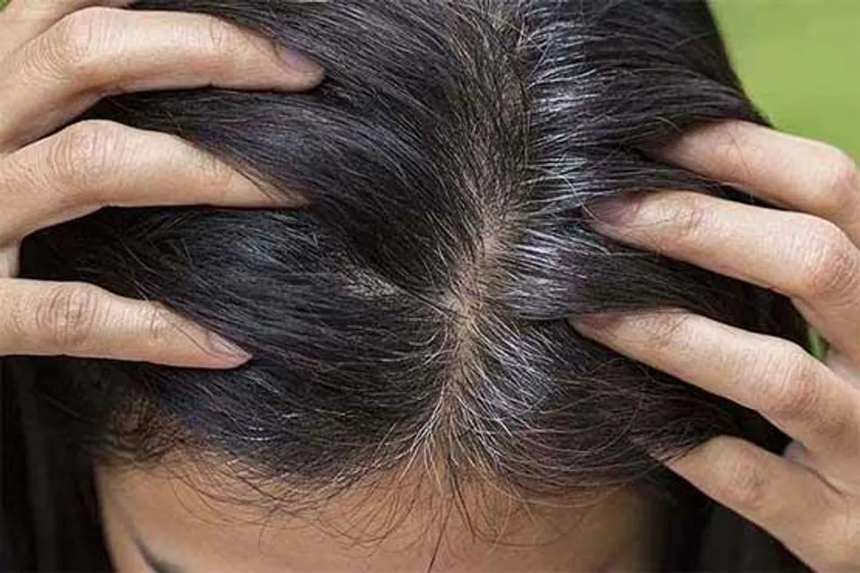 পাকা চুলের সমাধান রয়েছে চা পাতায়