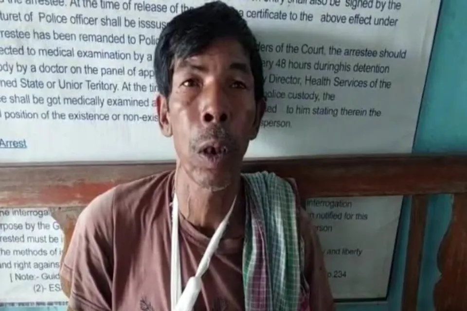 ডেবরায় মদ ব্যবসা করতে বারন করায় কাঠারির কোপ খেলেন এক ব্যাক্তি