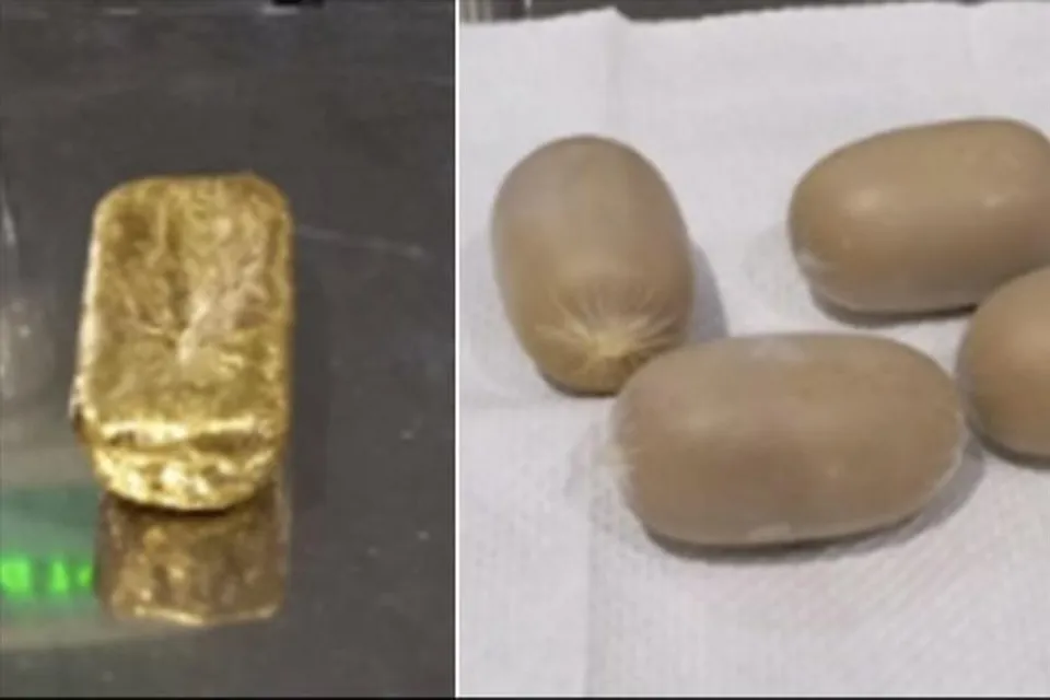 মলদ্বারে লুকিয়ে সোনা পাচার, গ্রেফতার দুবাই ফেরত যাত্রী