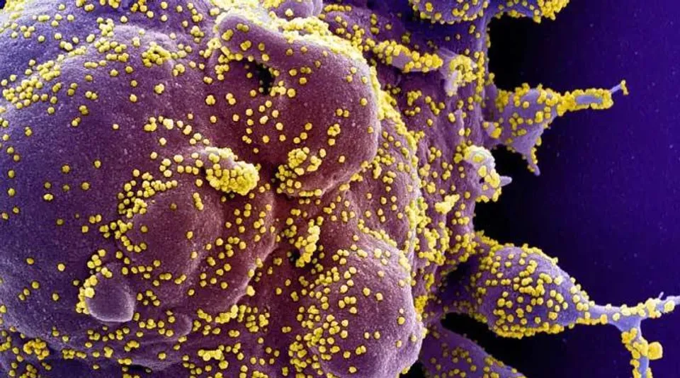 সাইপ্রাসে সন্ধান মিলল করোনার নয়া স্ট্রেন ডেল্টাক্রনের!