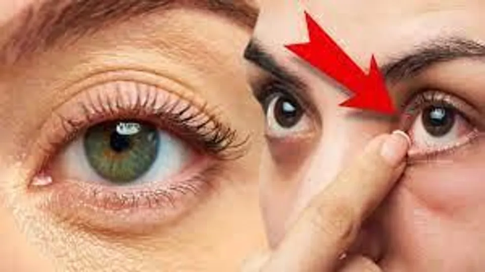 ডান চোখের পাতা ঘন ঘন লাফানো টা কি কোনো রোগ?