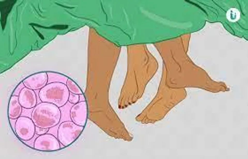 গনোরিয়া কি?