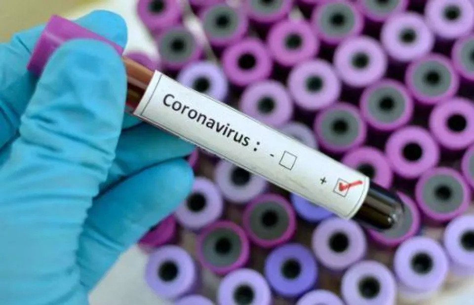 10 ministers and over 20 MLA's have tested positive for Corona