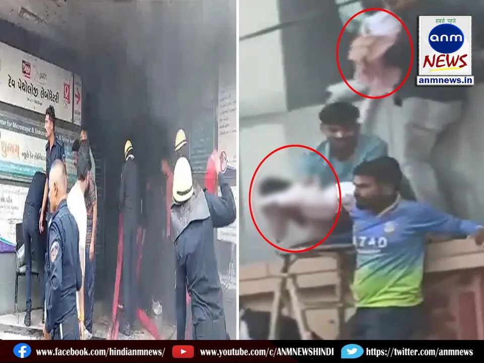 A fire broke out suddenly in a complex