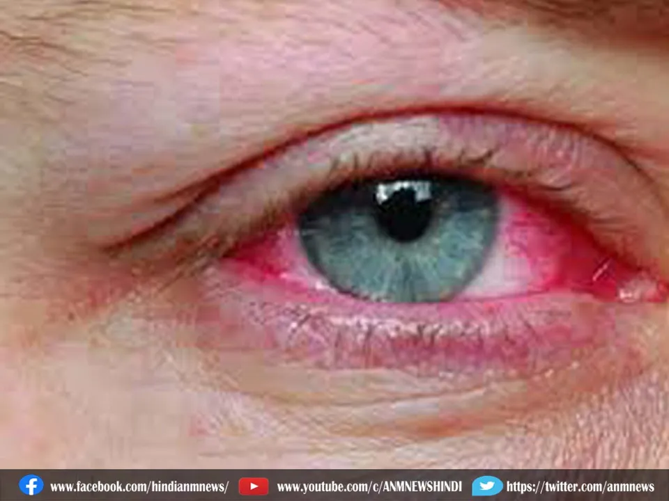eye