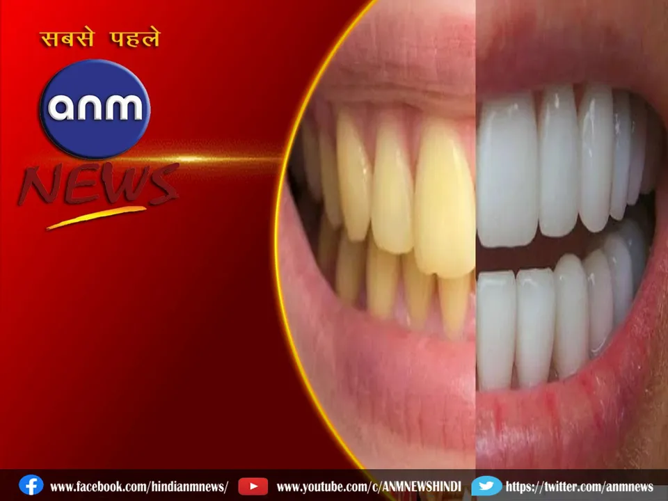 yellow teeth