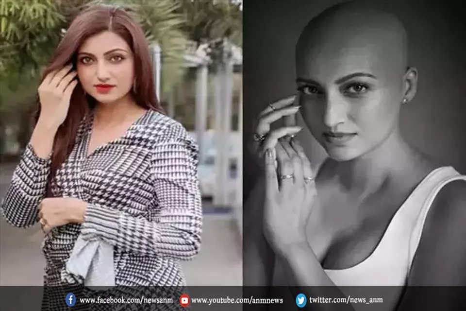 कैंसर पीड़ित एक्ट्रेस का फोटोशूट वायरल